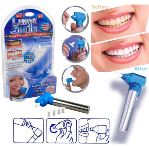 Luma Smile Tooth Polisher